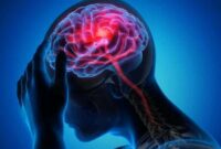 Pahami Perbedaan Sakit Kepala Biasa dan Sakit Kepala Gejala Stroke: Tanda-tanda Penting yang Harus Anda Ketahui