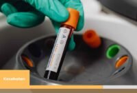 Seorang dokter Tiongkok telah menemukan subtipe darah P, yang pertama di dunia