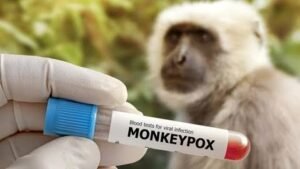 Pemprove DKI genjot vaksin monkey pox