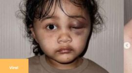 Viral! Anak Selebgram Aghnia Punjabi Dianiaya Pengasuhnya