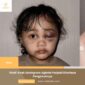Viral! Anak Selebgram Aghnia Punjabi Dianiaya Pengasuhnya