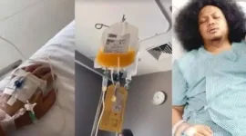 Pelajari Tentang Anemia Aplastik, Penyakit yang diderita Babe Cabita