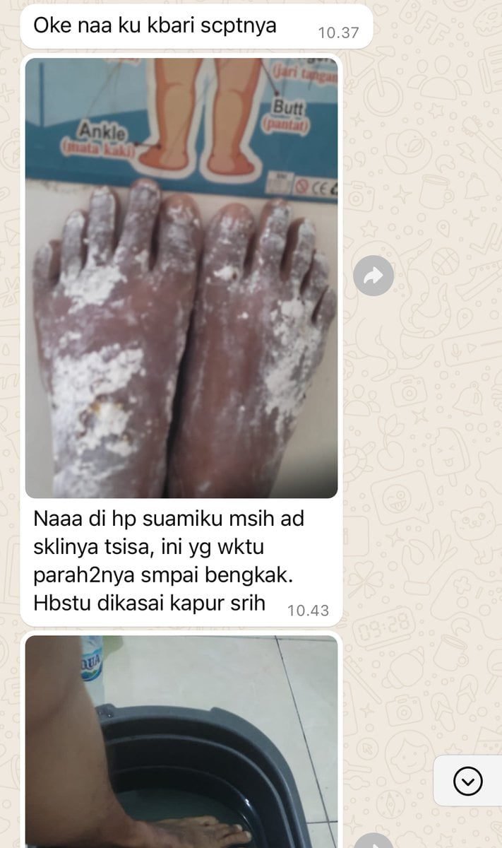 Kisah Nyata Pasangan Suami Istri Kena Santet Mematikan dari Sang Mantan