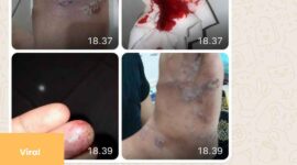 Kisah Nyata Pasangan Suami Istri Kena Santet Mematikan dari Sang Mantan