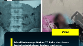 Pria di Indramayu Makan 70 Paku dan Jarum Pentul setelah dapat bisikan dari setan