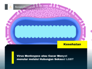 VIRUS MONKEYPOX ATAU CACAR MONYET MENULAR MELALUI HUBUNGAN SEKSUAL LGBT