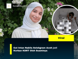 Cut Intan Nabila Selebgram Aceh jadi Korban KDRT Oleh Suaminya Cut Intan Nabila Selebgram Aceh jadi Korban KDRT Oleh Suaminya