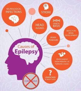 Epilepsi pada Anak: Memahami Penyebab, Gejala, dan Pengobatan Efektif untuk Kualitas Hidup Anak yang Lebih Baik Epilepsi pada Anak: Memahami Penyebab, Gejala, dan Pengobatan Efektif untuk Kualitas Hidup Anak yang Lebih Baik