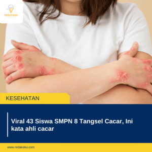 Viral 43 Siswa SMPN 8 Tangsel Cacar, Ini kata ahli cacar Viral 43 Siswa SMPN 8 Tangsel Cacar, Ini kata ahli cacar