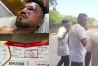 Pesawat Air India AI171 jatuh di Ahmedabad, satu penumpang ditemukan selamat dan kini dalam perawatan intensif. (Foto: Instagram @lambe_turah)