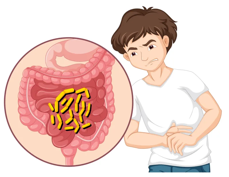 Ilustrasi seorang anak laki-laki mengalami gejala cacingan.
