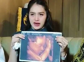 Viral Dugaan Anrez Adelio Hamili Kekasih, Friceilda Tempuh Jalur Hukum