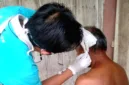 Dinas Kesehatan Blora mencatat 71 kasus baru kusta yang menyerang warga dewasa hingga anak-anak.