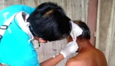 Dinas Kesehatan Blora mencatat 71 kasus baru kusta yang menyerang warga dewasa hingga anak-anak.